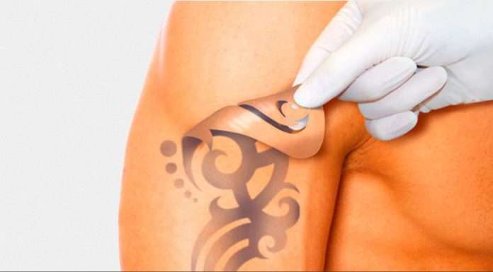 Як видалити тату