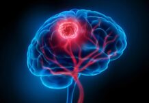 Виявлено походження раку мозку: клітини мутують за роки до виявлення