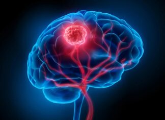 Виявлено походження раку мозку: клітини мутують за роки до виявлення