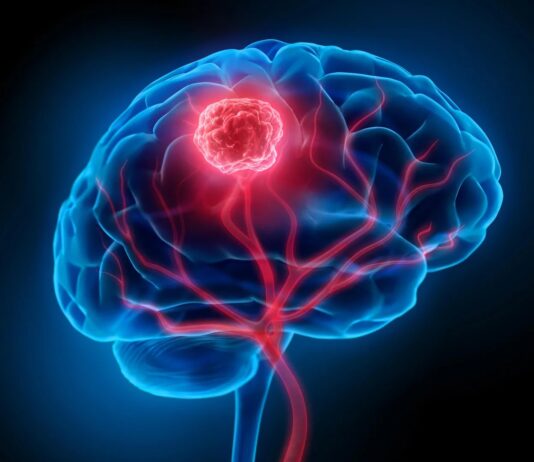 Виявлено походження раку мозку: клітини мутують за роки до виявлення
