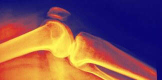 Игра вдолгую: как понять плотность костей и защитить их